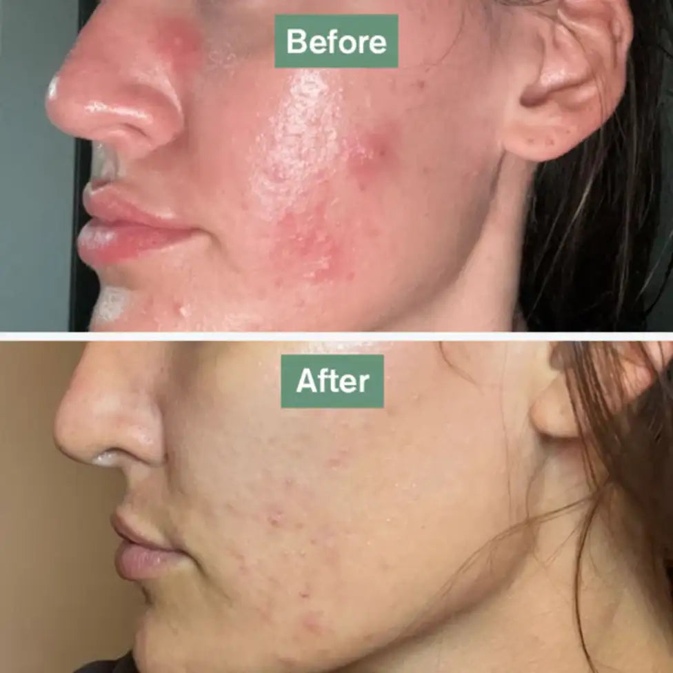 DR VEGAN Skin Saviour x 60