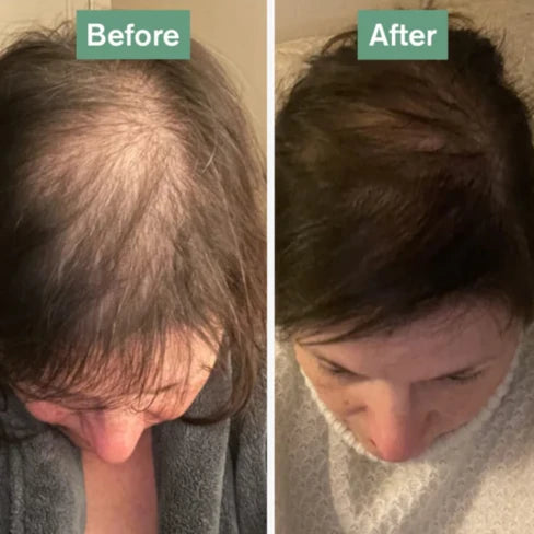 DR VEGAN Hair Saviour x 60